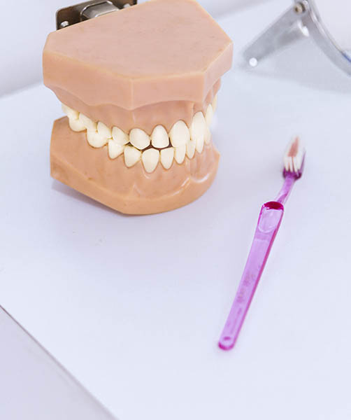 Clínica Dental Sonreimos - Que son las protesis dentales